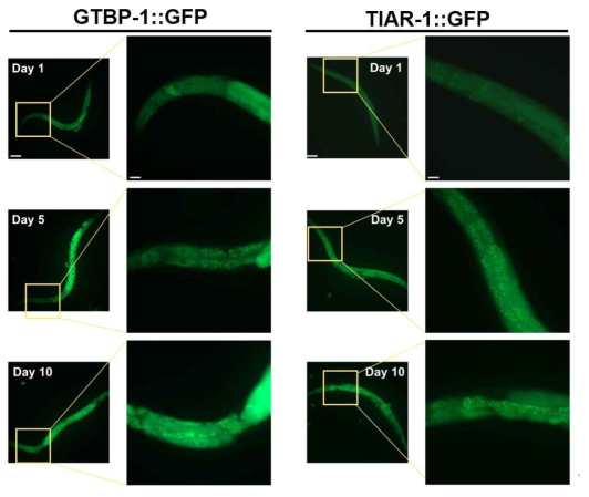 노화에 따른 GTBP-1과 TIAR-1을 포함한 스트레스 과립 형성 증가