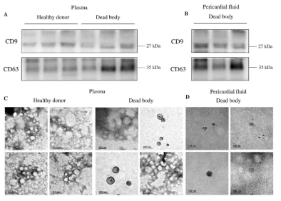 Analysis of the exosome derived from post-mortem body fluids