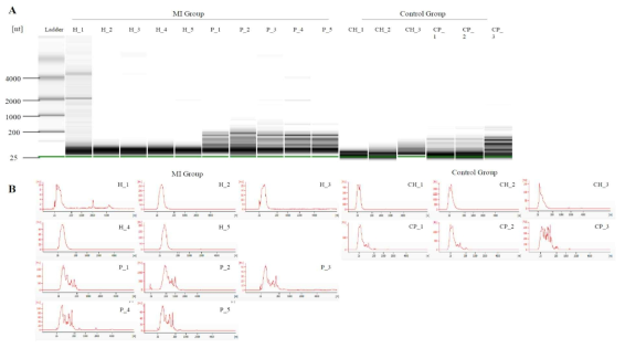 Quality control of post-mortem exosomal RNA. (A) In the migration pattern, bands of total exosomal RNA were observed to have the value between 25 and 200 nt. (B) The electropherograms show the peak distribution and fluorescence intensity (FU) of exosomal RNA. nt, nucleotide; H, exosomes from cardiac blood of MI group; CH, exosomes from cardiac blood of control group; P, exosomes from pericardial fluid of MI group; CP, exosomes from pericardial fluid of control group