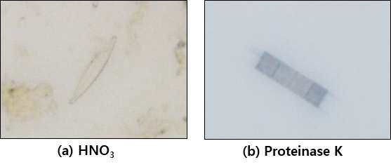 Diatoms from duodenal fluid digested with nitric acid and proteinase K