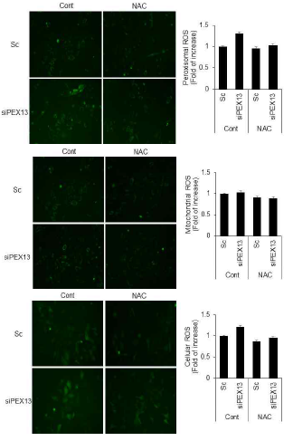 산화 스트레스 모니터링 시스템을 이용한 PEX13 발현 조절에 따른 퍼옥시좀, 미토콘드리아, 세포 산화 스트레스 변화 확인