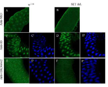 NSD SET domain deletion mutant 초파리의 salivary gland에서의 단백질 발현