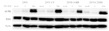 혈청 처리에 따른 NSD1 돌연변이 세포주의 ERK 인산화. 대조군과 NSD1 돌연변이 세포주 모두 ERK 인산화가 활발하게 일어나는 것을 확인함