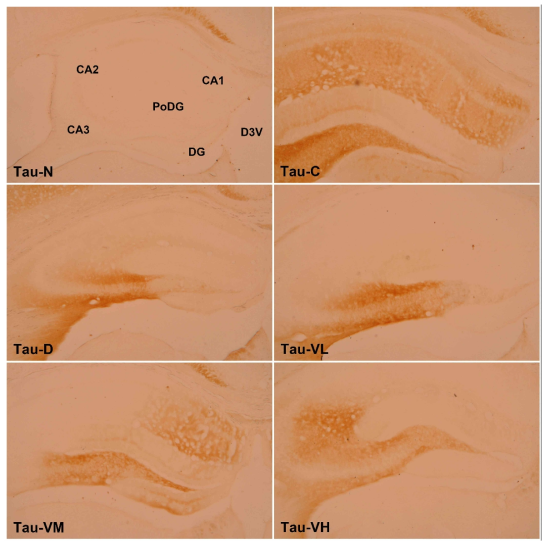 Effect of Verbenalin low, middle and high concentrations on Tau-protein positive fibers in the C57BL/6J and B6Cg-Tg mice hippocampus. Tau-N : Normal group(C57BL/6J mice), Tau-C(B6Cg-Tg mice) : Control Group, tau-D : Donepezil Group, Tau-VL : Verbenalin Low concentration Group, Tau-VM : Verbenalin Medium concentration Group, Tau-VH : Verbenalin High concentration Group; CA1 : Cornu Ammonis Area 1, CA2 : Cornu Ammonis Area 2, CA3 : Cornu Ammonis Area 3, PoDG : Polymorphic layer of the Dentate Gyrus, DG : Dentate Gyrus