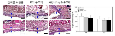 이식물 주변부의 capsule의 두께 비교