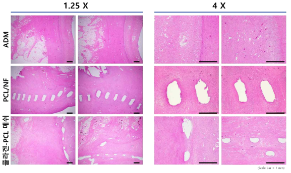돼지 동물모델에서 복합 나노섬유 구조체를 이식한 후 H&E 염색 결과>