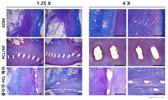 돼지 동물모델에서 복합 나노섬유 구조체를 이식한 후 Masson’s Trichrome 염색 결과