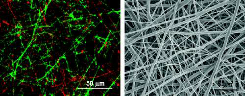 Biodegradable Polyurethane/ Poly(lactide-co-glycolide)을 이용하여 제작된 복합시트