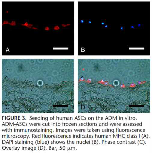 Stem cell seeding on ADM