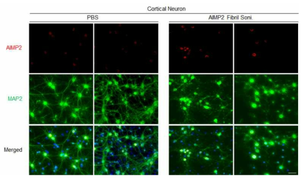AIMP2 응집체의 신경세포 유입 및 응집 병변 유도능 검증. Cortical neuron 배양에 대해서 PBS 및 재조합 AIMP2로부터 제조한 응집체를 처치한 후 AIMP2의 유입 및 병변 유도 를 AIMP2 항체를 이용하여 면역 형광 이미징 분석을 수행함. 신경세포를 MAP2를 이용하여 표지함