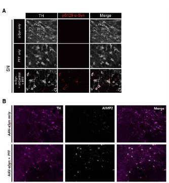 루이소체 발현 마우스 모델에서의 AIMP2 발현 및 분포. A. 마우스의 중뇌에 AAV-α-synuclein, PFF, 또는 두가지를 모두 주입한 후 3주 후에 루이소체 유사 응집체의 발현을 pS129-α-synuclein 특이 항체를 이용하여 면역 형광 염색 수행. 도파민 세포는 TH 항체로 표지함. B. α-synuclein AAV 또는 PFF와 α-synuclein AAV 바이러스를 함께 주입한 모델에서 AIMP2의 발현양 및 분포를 면역 형광 염색을 통해 이미징