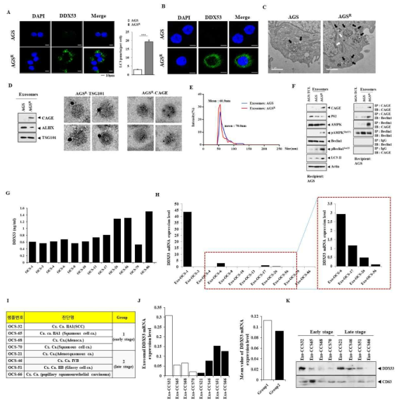 DDX53 mRAN and protein expressoin level in patinet-derived serum and exosome