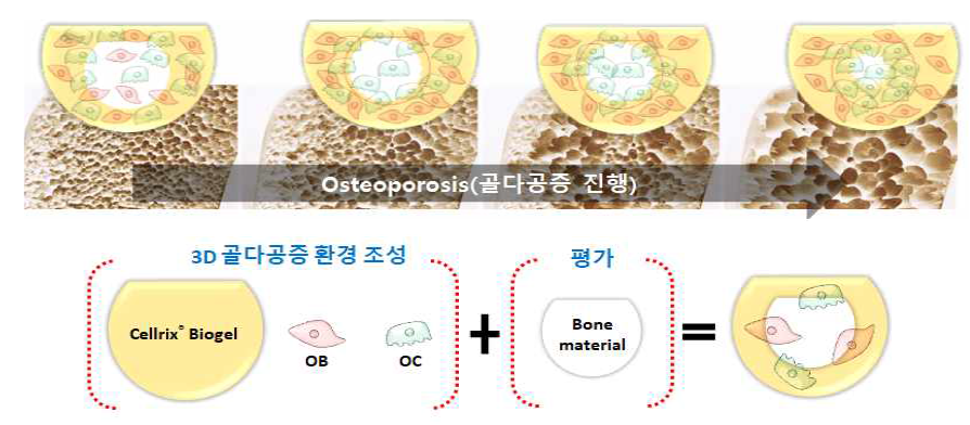 골다공증 평가시스템의 개념도