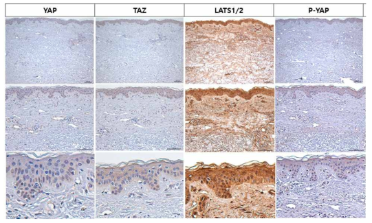 정상 피부에서 YAP, TAZ, LATS1/2, P-YAP 단백질들의 발현
