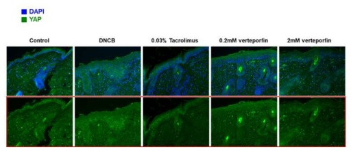 Nc/Nga 마우스 모델에서 아토피피부염 질환 및 YAP TAZ 관련 단백질 발현 변화