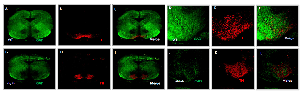 WT 및 ak/ak 마우스에서 GAD65/67 및 TH 발현 비교