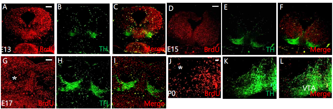중뇌의 발생과정에서 BrdU로 표시된 도파민신경의 신경세포 이동