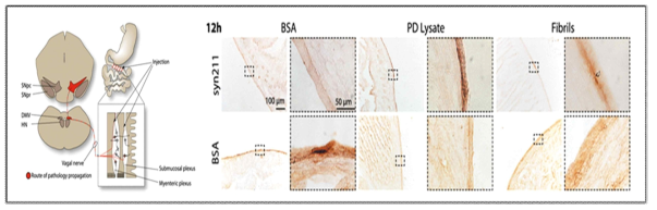 장내 α-synuclein 투여 시 장에서 뇌간으로의α-synuclein 이동 진행 과정