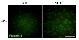세포모델에서의 후보약물 1H의 아연과의 연관성