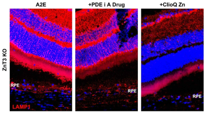 . 아연적중생쥐에서 후보약물 또는 PDE 억제제에 의한 라이소좀의 축적변화