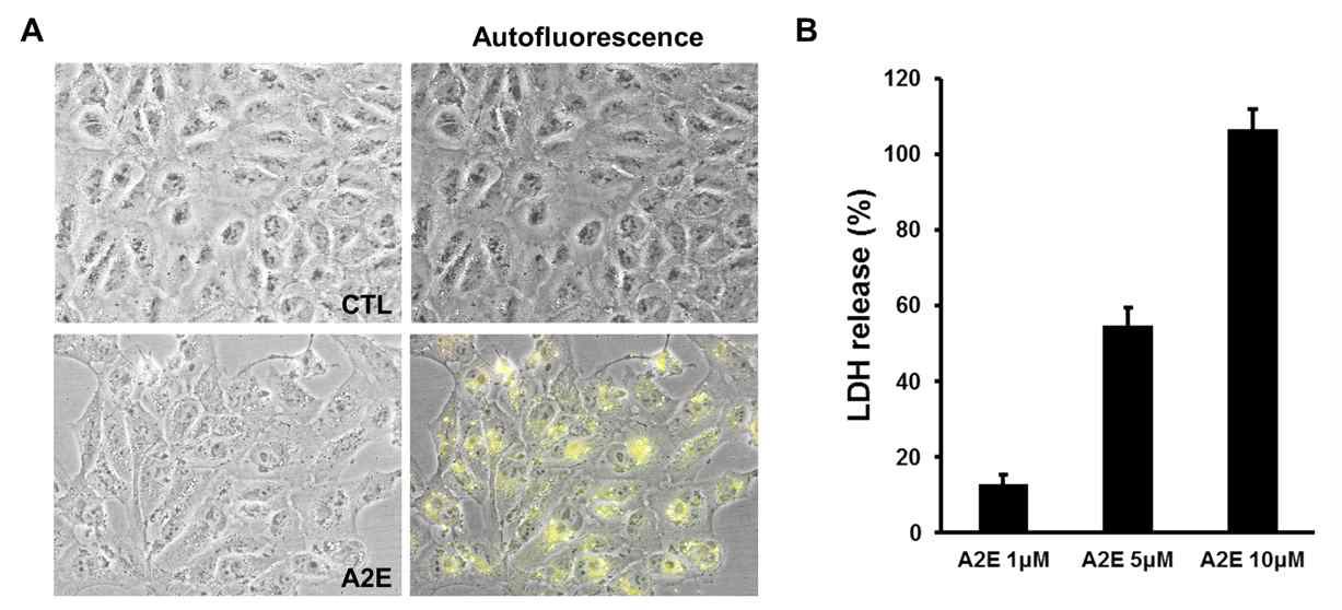 24시간 후 A2E의 세포내 축적 및 농도에 따른 세포사