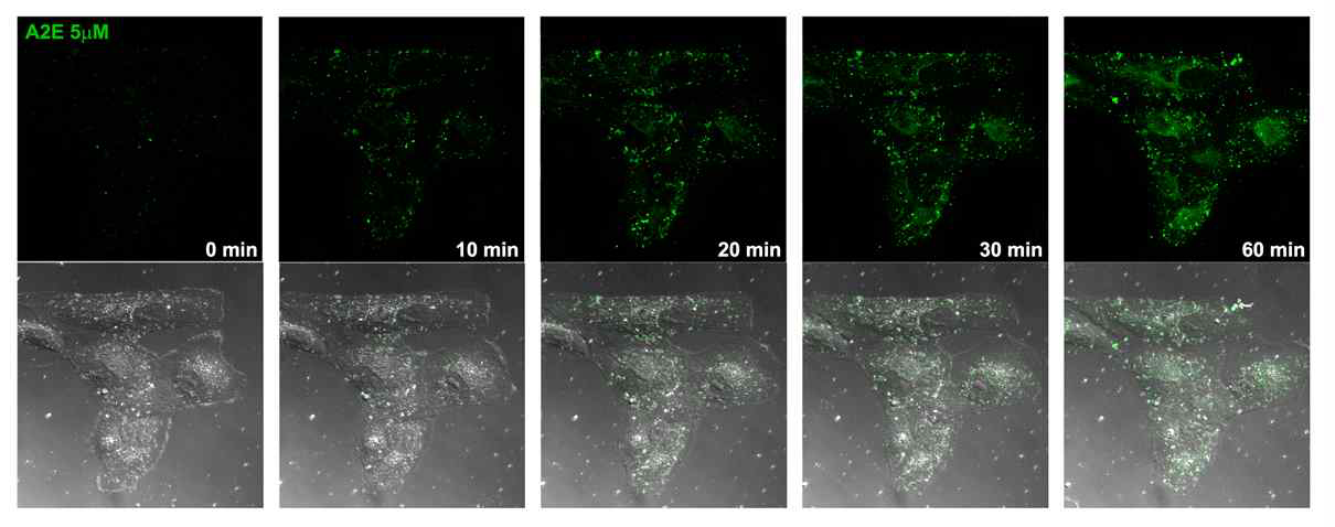 시간에 따른 A2E의 세포내 축적