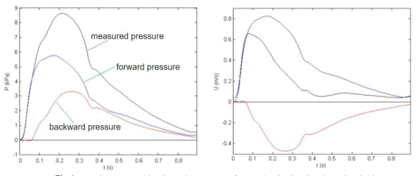 : forward pressure, backward pressure, forward velocity, backward velocity