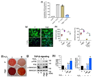 Catalytic and antioxidant activity of the nanoceria-tailored scaffolds salvages cells from high oxidative stress. (f) Intracellular ROS level, measured by H2DCFDA fluorescence assay (n = 3). MSCs were experienced high oxidative stress using H2O2 (0.5 mM). (g) Fluorescence images of cells (actin and nuclei were stained with phalloidin and DAPI, respectively) with or without H2O2, and (h) the cell number and spreading area were quantified by image J (*P < 0.05, student t-test). (i) Osteogenic differentiation under H2O2 (200 μM) was confirmed by ARS staining. Images are the representatives from three replicate samples (n = 3). (j n.s. indicating no significance, *p < 0.05, Student t-test, n = 3). (For interpretation of the references to color in this figure legend, the reader is referred to the Web version of this article.)