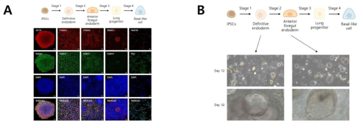 호흡 점막 상피세포 iPSCs로부터 호흡기도 줄기세포로의 분화 및 발현인자 확인 (A), 호흡 점막 상피세포 iPSCs로부터 상기도 점막 오가노이드의 분화 확인 (B)