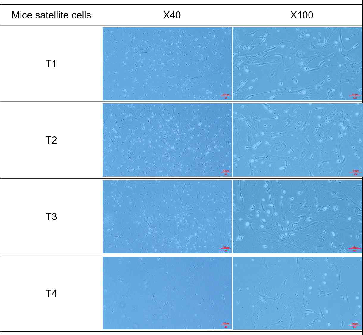 Proliferation of satellite cells obtained from mice muscle. T1, normal mice; T2, mice were treated with the gut microbiota (E.coli(1*108CFU/mL) and L.casei(1*104CFU/mL)); T3, mice were treated with dexamethasone (1mg/kg body weight); T4, elderly mice