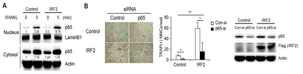 NF-κB p65의 핵 내로 이동에 IRF-2가 미치는 영향