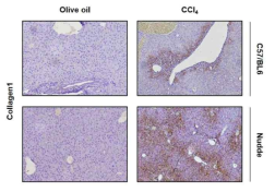 C57BL/6 WT 마우스와 면역이 겹핍된 NOD/SCID 마우스에 CCl4를 처리하면 면역 결핍 마우스의 간에서 섬유화 증상이 더욱 심하게 나타난다. CCl4 처리 (5ml/kg, 10% CCl4 in olive oil, 2번/주) 후 간 섬유화 마커 중 하나인 collagen의 활성 증가를 IHC를 통해 관찰하였다. CCl4를 동일 기간, 동일 농도로 처리했음에도 불구하고 면역이 결핍된 NOD/SCID 마우스의 간에서 섬유화가 더 심하게 진행된 것을 확인하였다