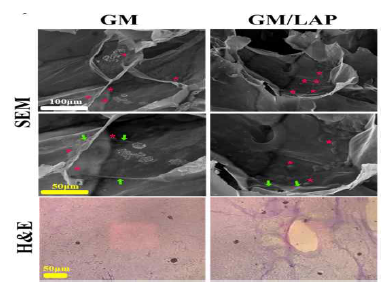 GM과 GM/LAP 하이드로겔의 SEM과 H&E 분석 결과