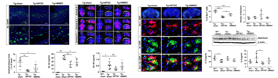 알츠하이머병 동물모델에서 hNTSCs 뇌 이식에 따른 베타아밀로이드 발현 및 염증세포 감소