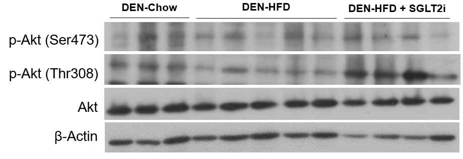 고지방 식이와 화학물 유도 간암 동물 모델의 세 군에서 Western blot을 이용한 p-Akt와 Akt 의 단백질 발현 비교 DEN-Chow, DEN과 정상 식이 투여군; DEN-HFD, DEN과 고지방 식이 투여군; DEN-HFD + SGLT2i, DEN에 고지방 식이와 SGLT-2 억제제 (SGLT-2 inhibitor [dapagliflozin])의 혼합사료 투여군.