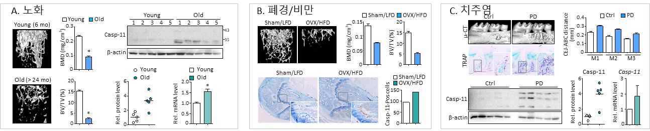 골다공증 모델의 뼈 조직에서 Caspase-11의 발현 증가 다양한 골다공증 동물모델-노화(A), 폐경/비만(B), 치주염(C)-의 뼈 조직에서 Caspase-11 발현 증가를 Western blot, qPCR, immunohistochemical staining 등으로 확인함