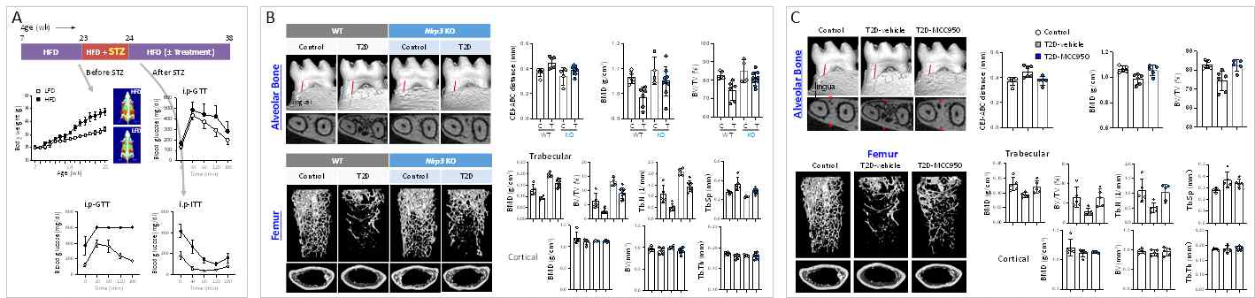 2형 당뇨 매개 골소실에서 NLRP3 인플라마좀 억제의 효능 (A) 2형 당뇨 생쥐 모델 구축. (B) NLRP3 wild-type과 knock-out 생쥐 각각에 2형 당뇨를 유발한 후 micro-CT 분석을 통해 치조골과 대퇴골의 골 지표를 비교 분석함. (C) Wild-type 생쥐에 2형 당뇨를 유발한 후 PBS 또는 MCC950을 투여한 후 micro-CT 분석을 통해 치조골과 대퇴골의 골 지표를 비교 분석함