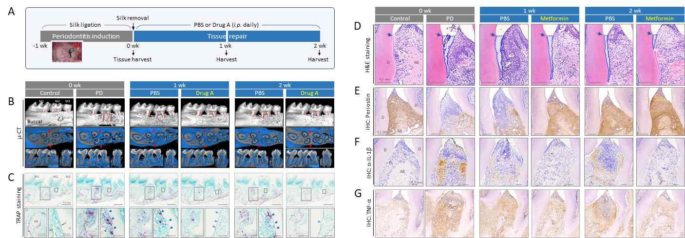 당뇨치료제 Metformin을 활용한 치주조직 재생 방법 개발 (A) 치주염 유발을 위해 생쥐 M2 molar에 1주일간 결찰한 실크를 제거한 후 PBS 또는 Metformin을 2주 동안 투여함. (B-G) 치주조직 재생을 다양한 조직학적 분석법으로 확인함. (B) μ-CT 분석, (C) TRAP 염색, (D) PDL pocket 분석, (E) Periostin 면역염색, (F) IL-1β 면역염색, (G) TNF-α 면역염색