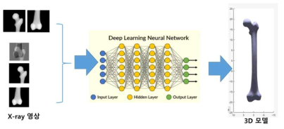 딥러닝 기반 환자 맞춤형 3차원 대퇴뼈 모델 생성