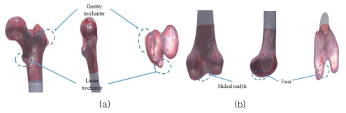 모델 중첩을 통한 3차원 대퇴뼈 모델의 평가 (회색: 원래 모델, 빨간색: 딥러닝을 통해 생성된 모델); (a) 근위부 대퇴뼈 (b) 원위부 대퇴뼈