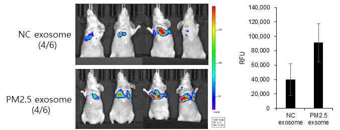 미세먼지 노출 세포 유래의 엑소좀 주입에 의한 폐암 전이 증가