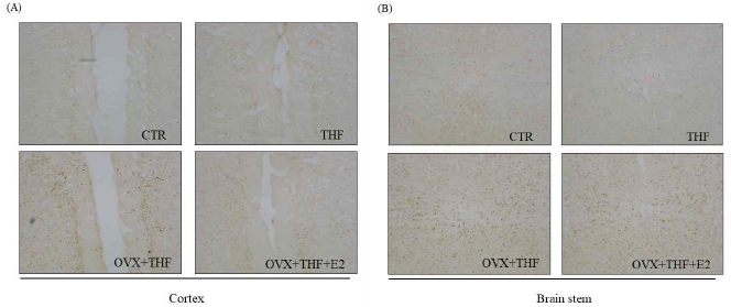 Immunohistochemistry (A) GPER in cerebral cotex, (B) GPER in the brain stem