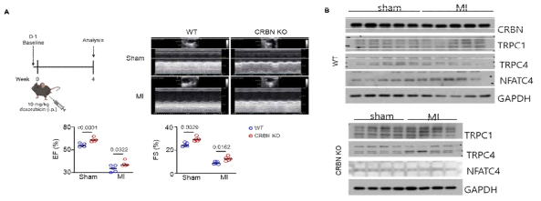A)심근경색모델(myocardial infarction) 제작 후 심장초음파를 이용한 심장 수축-이완 기능 분석 B)CRBN 과 TRPC1/4와 심장비대마커단백질(NFAT) 발현 비교 분석