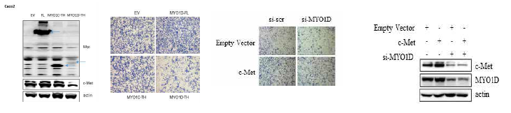 MYO1D의 과발현 및 발현억제 후 c-Met 기능과의 연관성 분석