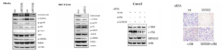 c-Met에 의해 활성화되는 downstream signaling pathway에 MYO1D가 미치는 영향과 MYO1D 발현 억제에 의해 감소되었던 c-Met의 분해 기전 분석