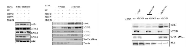 MYO1D 발현 억제 후 c-Met의 세포내 위치와 분포 확인