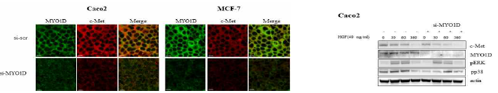 MYO1D 발현 억제 후 c-Met과 MYO1D의 colocalization 변화와 MYO1D 발현 억제 후 c-Met의 세포내 위치와 분포 확인