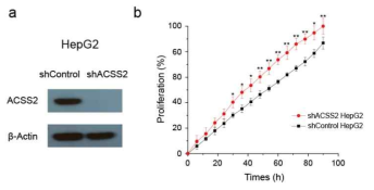 ACSS2 shRNA의 세포성장에 있어서의 영향