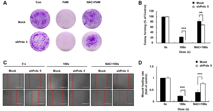 NAC 처리는 PRDX5 억제 후의 A549 세포에서 PAM의 악성 행동 억제 효과를 제거했습니다. (A) 판에 달라붙은 암세포들의 첫 날 이미지; 세포들은 NAC로 전처리함. 배양 매질을 제거하고, PAM과 NAC를 첨가했습니다. (B) PAM 노출 후 7일 동안 A549 세포들의 세포집단 형성 능력을 탐지하기 위해 세포집단 형성 실험을 수행했습니다. (C) 상처 치유 실험의 이미지. (D) 상처 치유 면적의 양적 분석