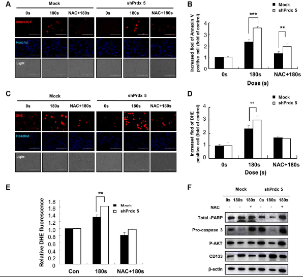 NAC 처리가 PRDX5 저밀도 A549 폐암세포의 세포 내 ROS 함량에 미치는 영향. (A) NAC 처리 후 Annexin V 염색을 사용하여 PAM에 노출된 A549 세포의 이미지. (B) Annexin V 염색의 상대적 형광 강도 그래프. (C) NAC 처리 후 DHE 염색을 사용하여 PAM에 노출된 A549 세포의 이미지. (D) DHE 염색의 상대적 형광 강도 그래프. (E) DHE 염색을 사용한 A549 세포의 세포 내 ROS 생성에 대한 플로우 사이토메트리 분석. (F) NAC 처리 후 AKT, pro-caspase 3 및 PARP를 포함한 세포 사멸 관련 단백질의 웨스턴 블로팅